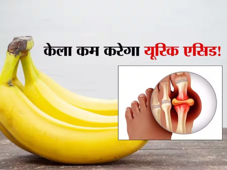 यूरिक एसिड कंट्रोल करने के लिए केला का सेवन: जानें कैसे यह आपकी सेहत को लाभ पहुंचाता है