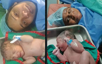 छत्तीसगढ़: दुर्ग जिले में एक चौंकाने वाला मामला; अस्पताल में नवजात बच्चों की अदला-बदली, मुस्लिम परिवार मांग रहा अपना बच्चा, हिन्दू देने को तैयार नहीं, दो परिवारों के बीच जमकर विवाद, DNA टेस्ट से होगा खुलासा!
