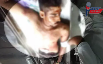 हाथापाई के बाद चाकूबाजी: दो भाइयों ने युवक पर किया ताबड़तोड़ हमला, पीड़ित की हालत बेहद गंभीर....