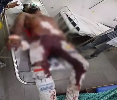 बर्थडे पार्टी के दौरान खूनी झड़प, चाकू से जोरदार हमला – युवक की अंतड़ियां बाहर हालत गंभीर!