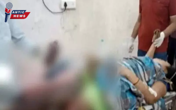 CG - मासूम महिला बनी शिकार: कायर नक्सलियों के IED ब्लास्ट में महिला का पैर पूरी तरह से हुआ क्षतिग्रस्त....