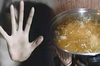 100 रुपये के लिए हैवानियत! युवक ने भाई पर फेंका खौलता तेल, पूरा मामला जानकर दहल उठेगा आपका दिल…...