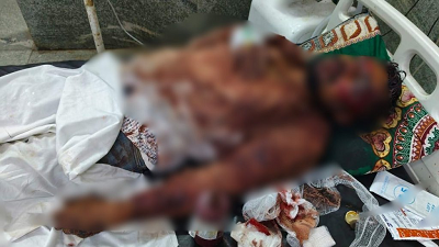 खौफनाक वारदात: दोस्तों ने ही दोस्त पर चाकू से किया हमला, फिर मरा समझकर...